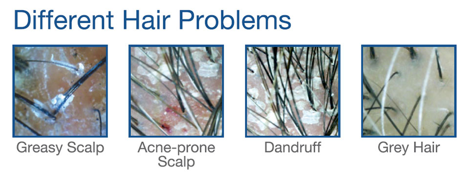 Got Hair Issues, Fellow Runners? Trichologists Can Resolve Them!