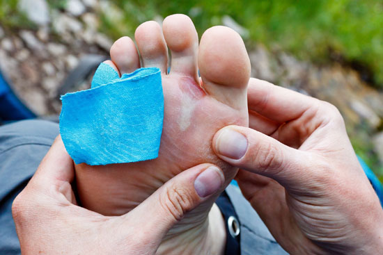 Bad Running Habits that Let Blisters Throw Runners Off Stride
