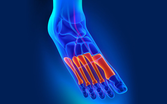 Understanding Common Running Injuries and How to Prevent Them