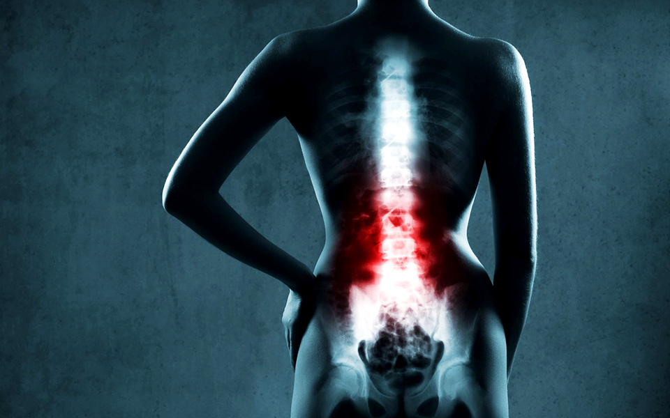 How Your Back Pain is Killing You Slowly
