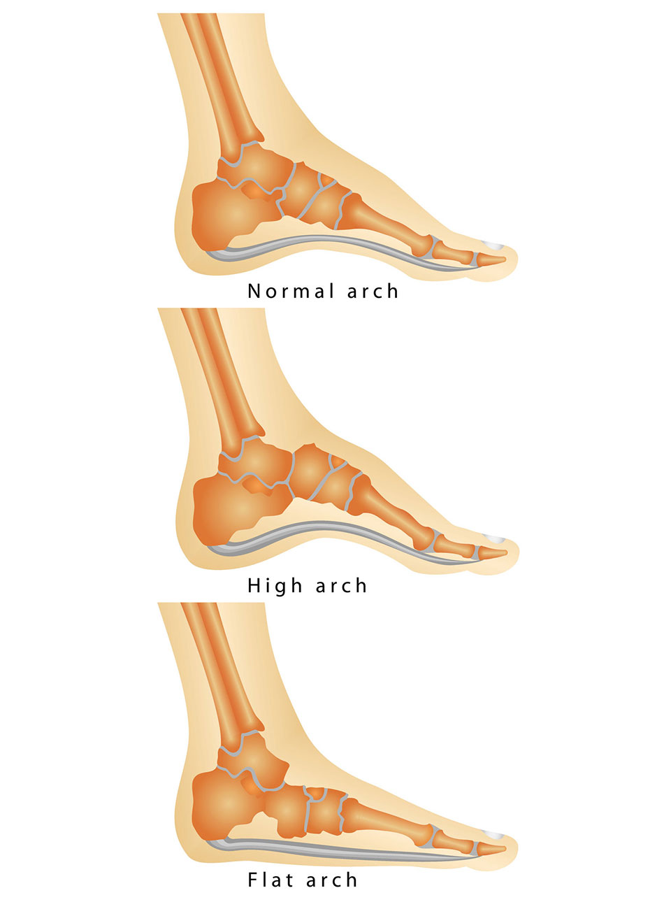 best running shoes for narrow flat feet on How To Pick A Good Pair Of Suitable Running Shoes For You