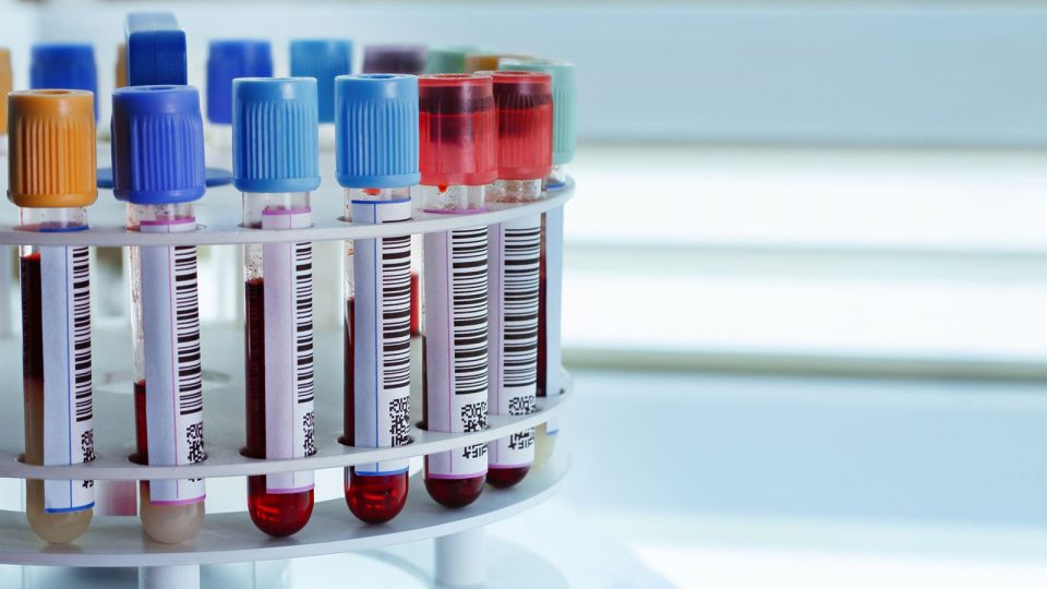 Why It's So Important For Runners to Know Their Blood Type!